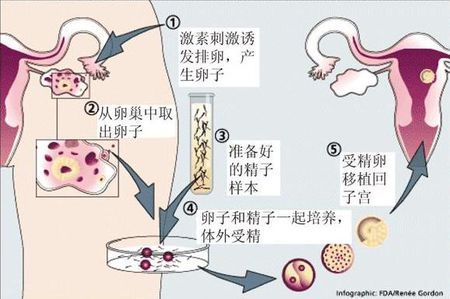 好韵多次失败疑难中心