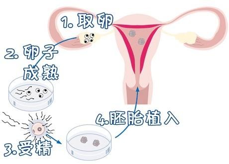 案例